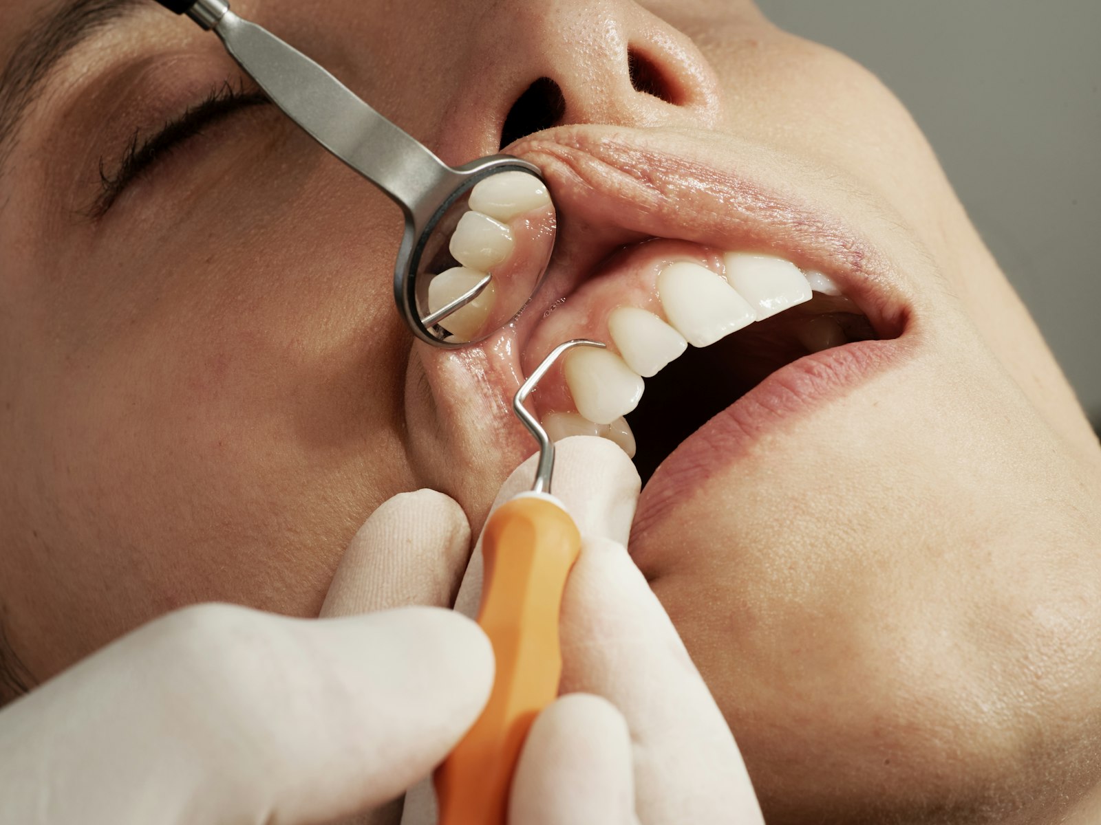 Dental clinician treating a patient in a bright clinic